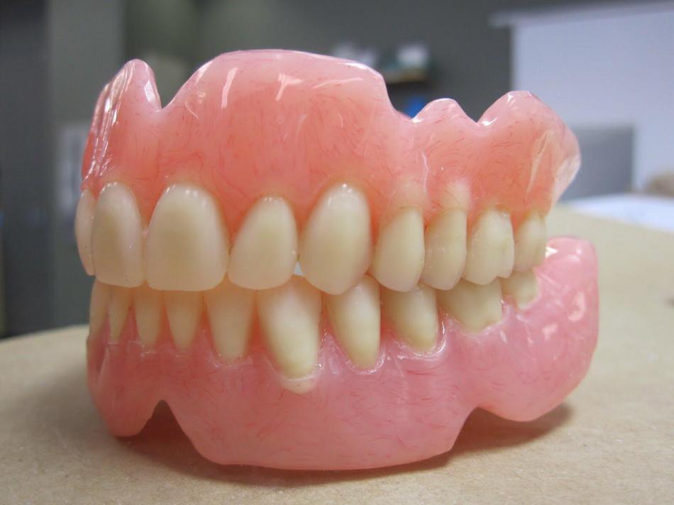 Плюсы и минусы зубных акриловых протезов.