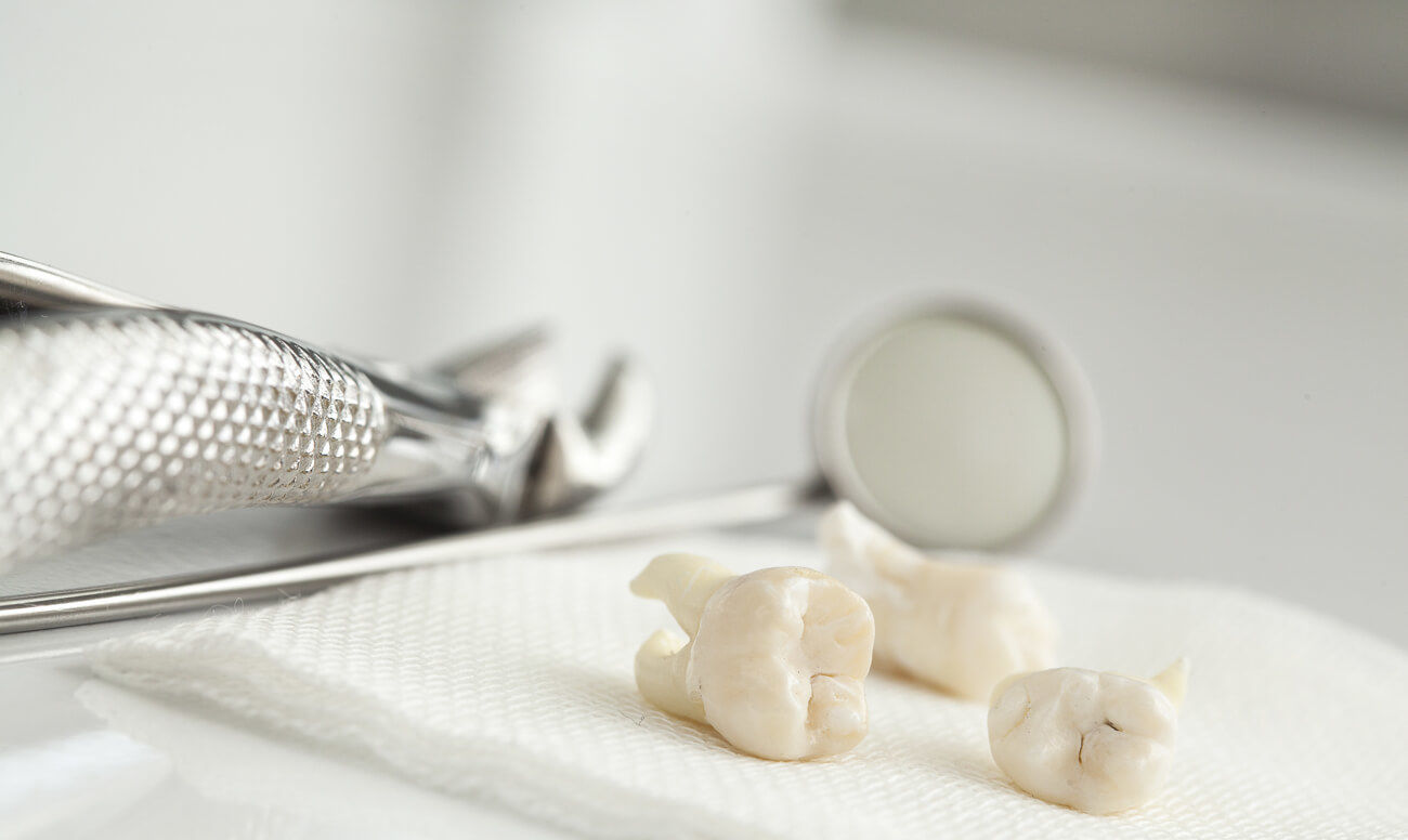 Стоимость удаления зуба в стоматологии.