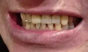 Фотография Аэлита 2