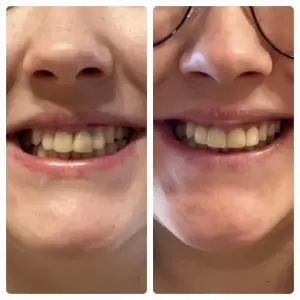 Фотография Светлана 3